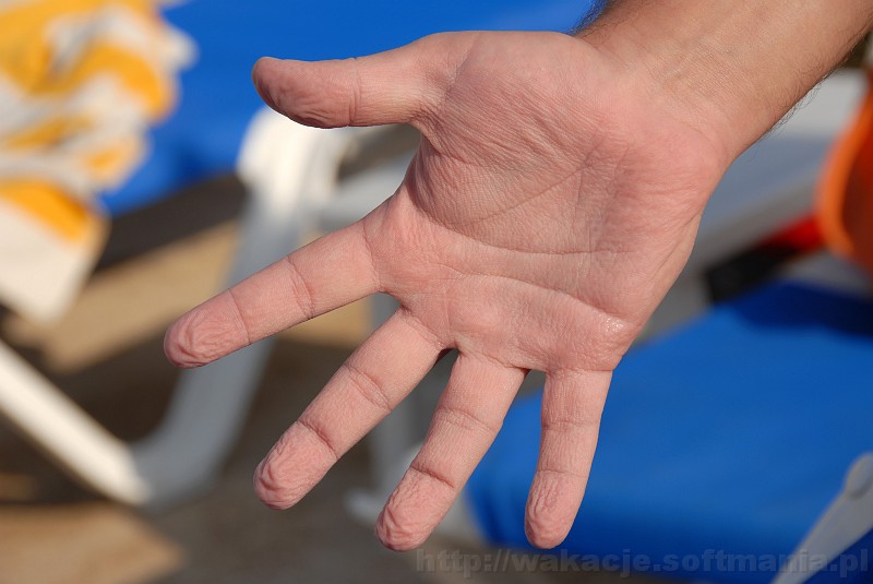 024_egipt_sharm.jpg - Ręka po wielogodzinnym siedzeniu w basenie :-)